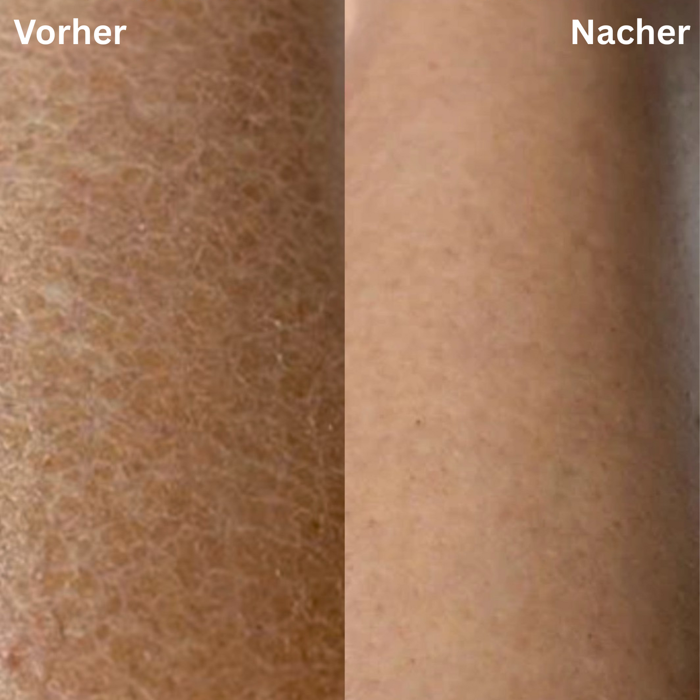 LOOMSKIN™ - Premium Hautpflegetuch